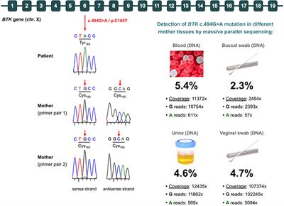 Uncovering Low-Level Maternal Gonosomal Mosaicism in X-Linked Agammaglobulinemia: Implications for Genetic Counseling